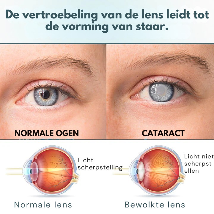 Vordela® OptiFusion Nano Oogdruppels Serum