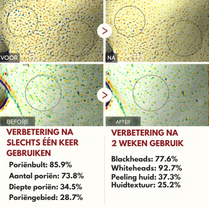 Vordela® Peel Shot Glow Zwarte Rijst Ampul