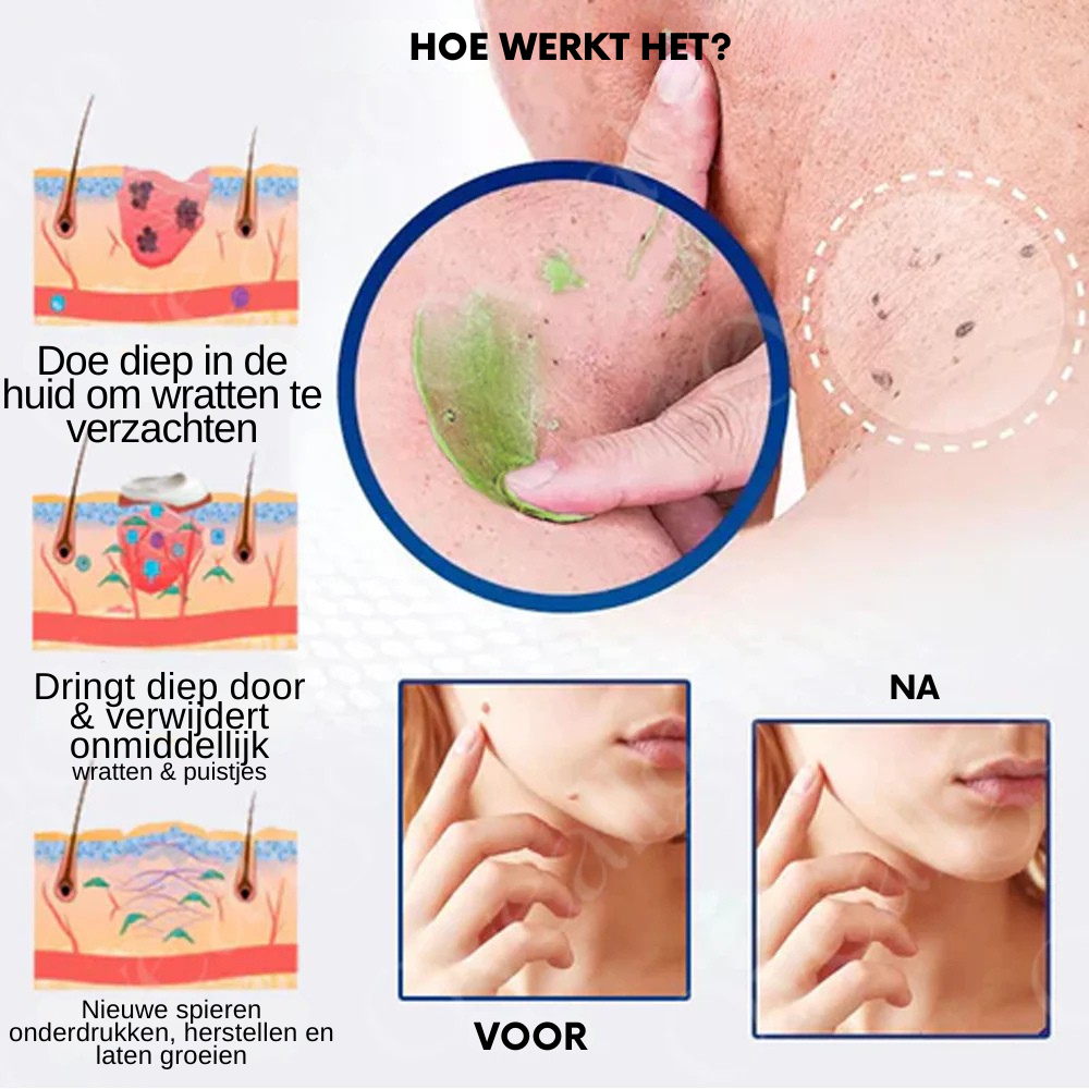 Officiële winkel: Vordela™ NatureErase Instant Mole & Spot Crème