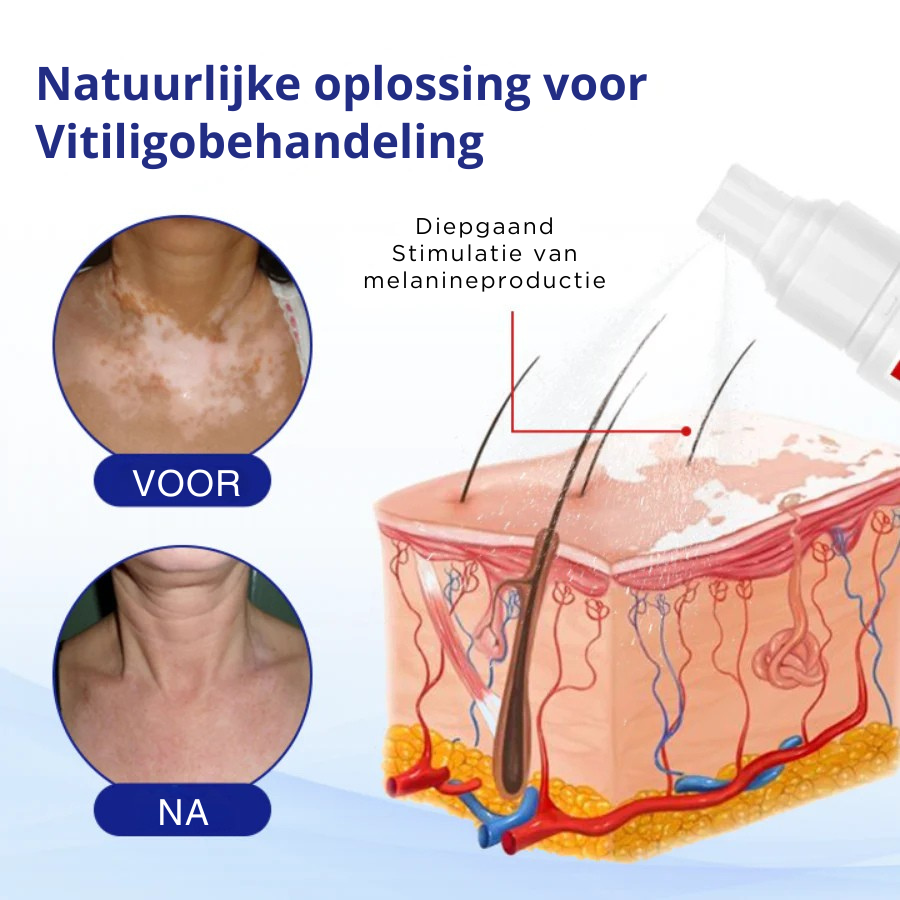 Vordela® VitiClear kruidenspray