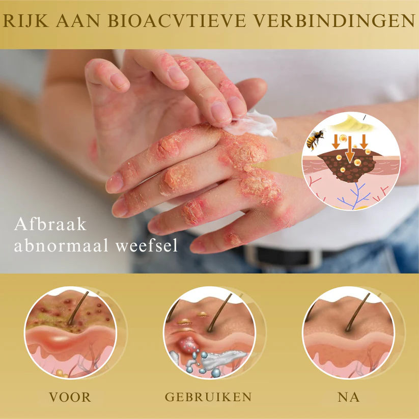 Vordela® Gecondenseerd Mellifera-gif Huidherstellende Crème