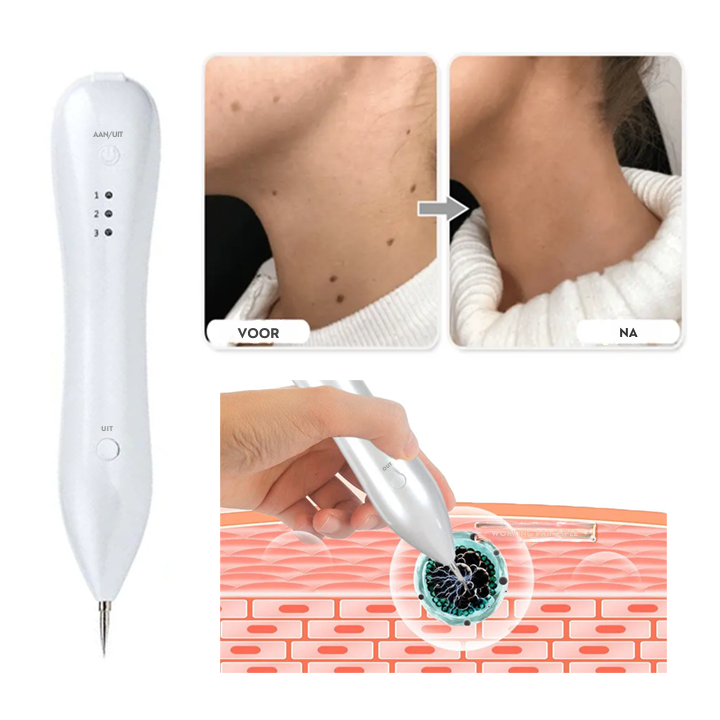 Vordela® Geavanceerde Plasma Laser Spot Schoonmaakpen