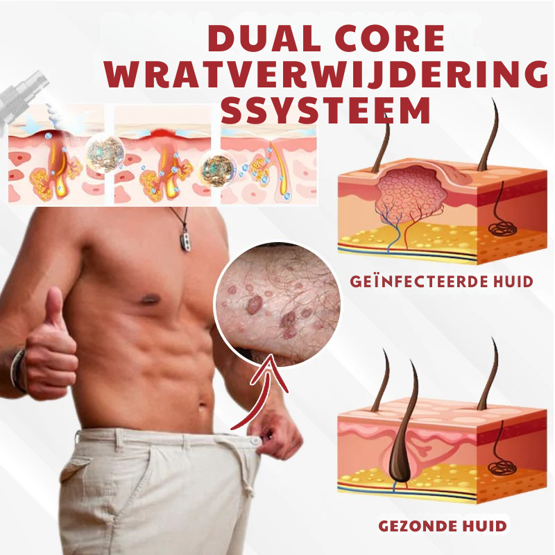 Vordela® HPV Wratten Verzorgingsspray voor mannen