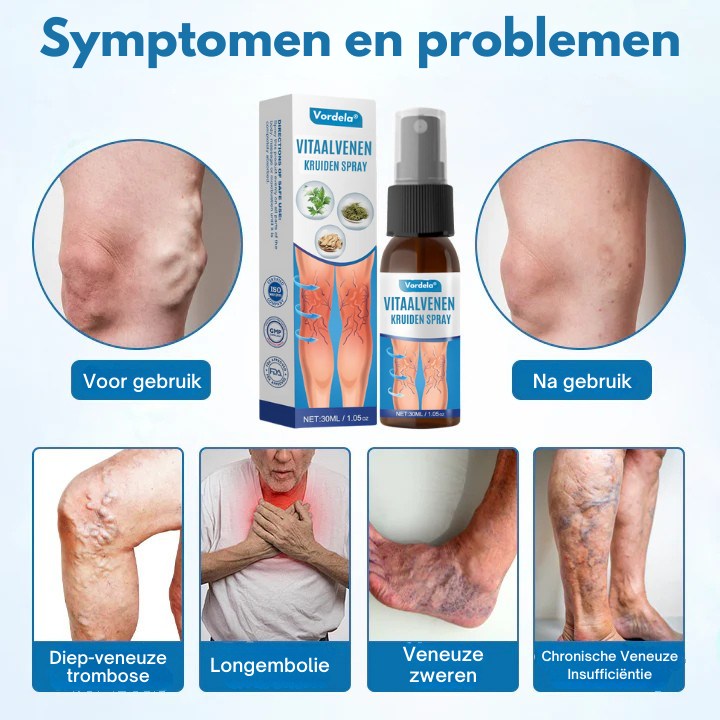 Vordela® VitaalVenen Kruiden Spray 🔥