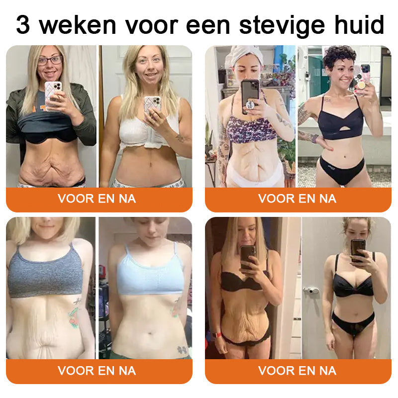 Gemaakt✨ en verzonden vanuit Nederland|✅ Officiële winkel Vordela® Herstellende Crème met  Bijengif 🔥