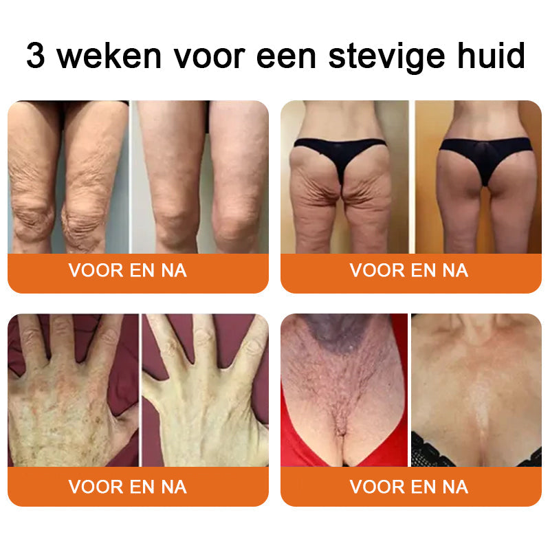 Gemaakt✨ en verzonden vanuit Nederland|✅ Officiële winkel Vordela® Herstellende Crème met  Bijengif 🔥
