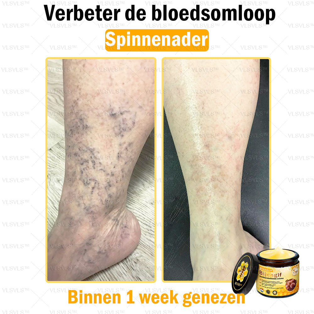 Vordela™ Bijengif Huidherstellende Crème