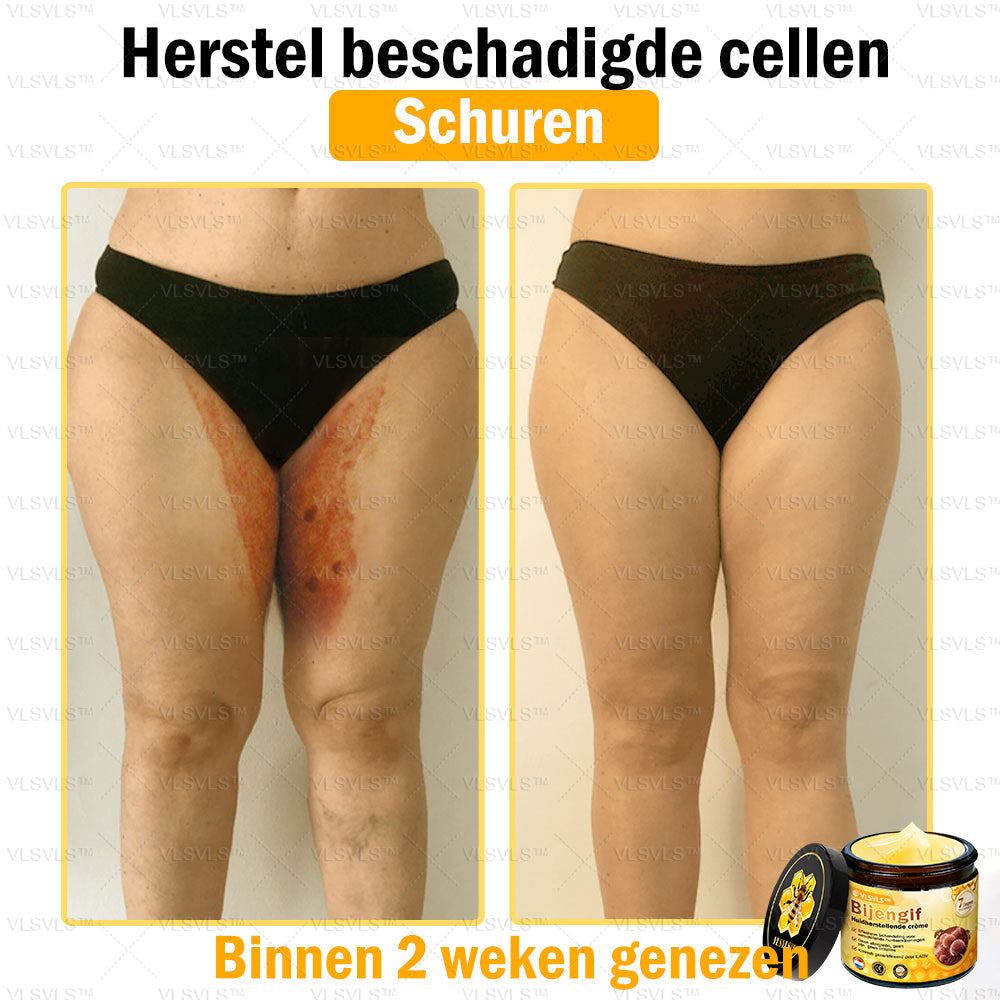 Vordela™ Bijengif Huidherstellende Crème