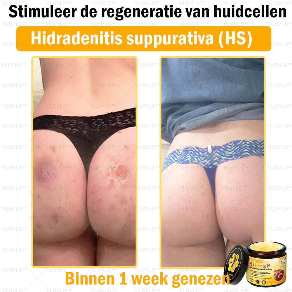 Vordela™ Bijengif Huidherstellende Crème