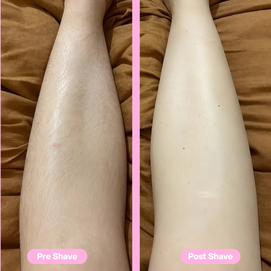 SilkLady Pro™ | Voor een Gladde Huid Zonder Irritatie – Draadloos & Waterdicht Scheerapparaat