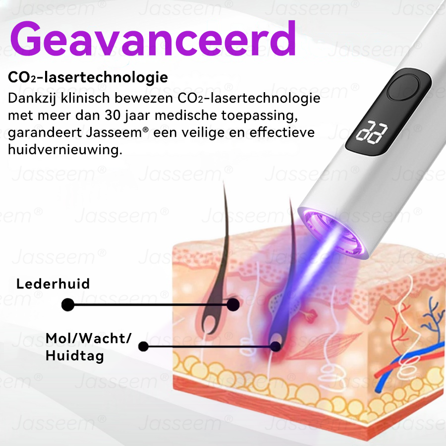 Vordela- Geavanceerde Niet-Invasieve Huidherstel CO₂-Laserpen