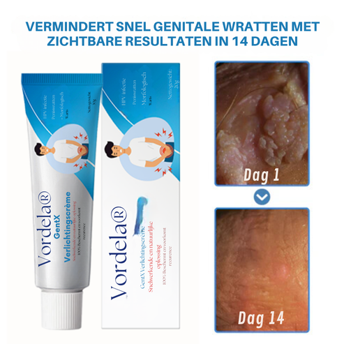 Vordela® HPV Genitale Wratten Verlichtingscrème