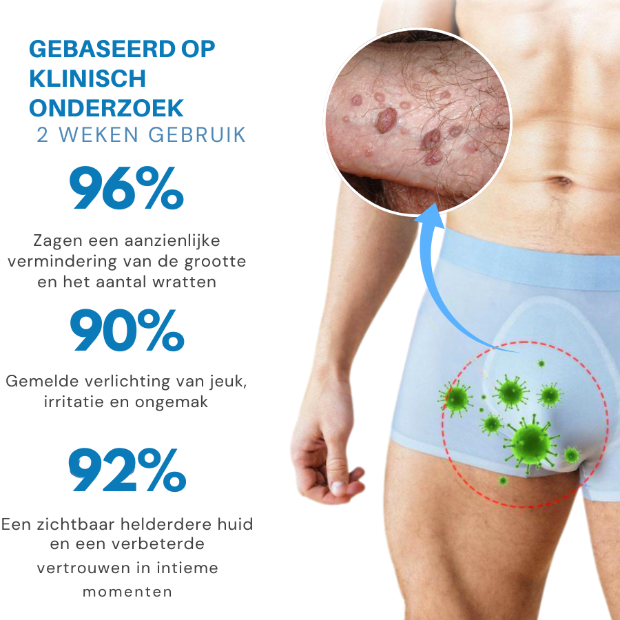 Vordela® HPV Genitale Wratten Verlichtingscrème