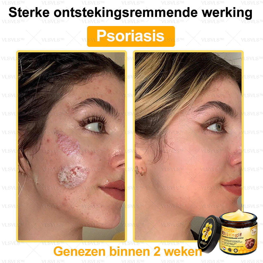 Vordela™ Bijengif Huidherstellende Crème