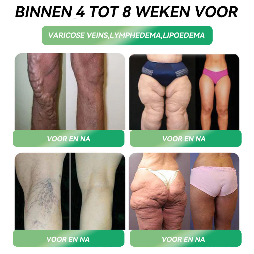 [Zie resultaten in 10 dagen]🏆Vordela® GLP-1 Orale Oplossing Voor Gewichtsverlies– al na 10 dagen zichtbaar resultaat