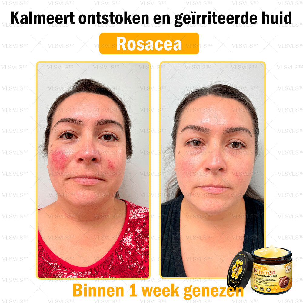 Vordela™ Bijengif Huidherstellende Crème