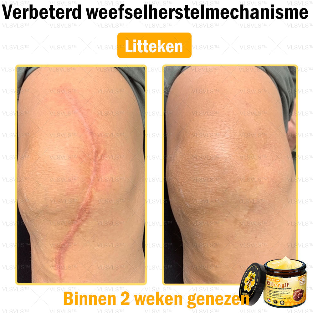 Vordela™ Bijengif Huidherstellende Crème
