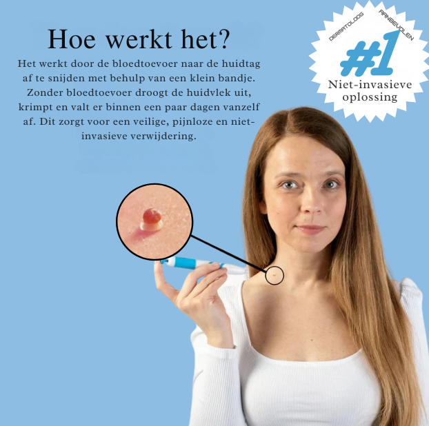 Vordela - TagBuddy Kit - Geen huidmarkeringen meer