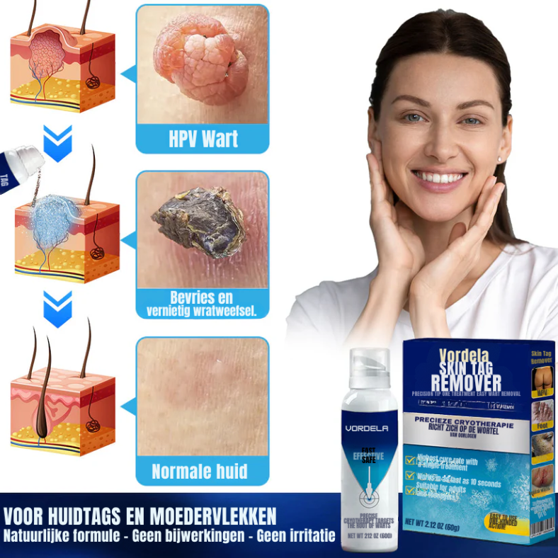Vordela® TagRecede Cryobehandelingsspray