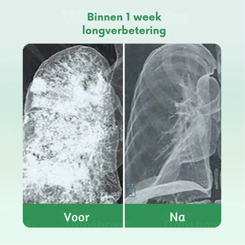 Vordela® 𝐇𝐞𝐫𝐛𝐚𝐥 𝐋𝐮𝐧𝐠 𝐂𝐥𝐞𝐚𝐧𝐬𝐢𝐧𝐠 𝐈𝐧𝐡𝐚𝐢𝐞𝐫(🫁hoest, piepende ademhaling, kortademigheid, sputum, verstopte neus, longklachten)