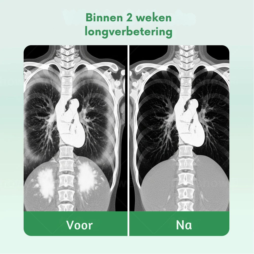 Vordela® 𝐇𝐞𝐫𝐛𝐚𝐥 𝐋𝐮𝐧𝐠 𝐂𝐥𝐞𝐚𝐧𝐬𝐢𝐧𝐠 𝐈𝐧𝐡𝐚𝐢𝐞𝐫(🫁hoest, piepende ademhaling, kortademigheid, sputum, verstopte neus, longklachten)