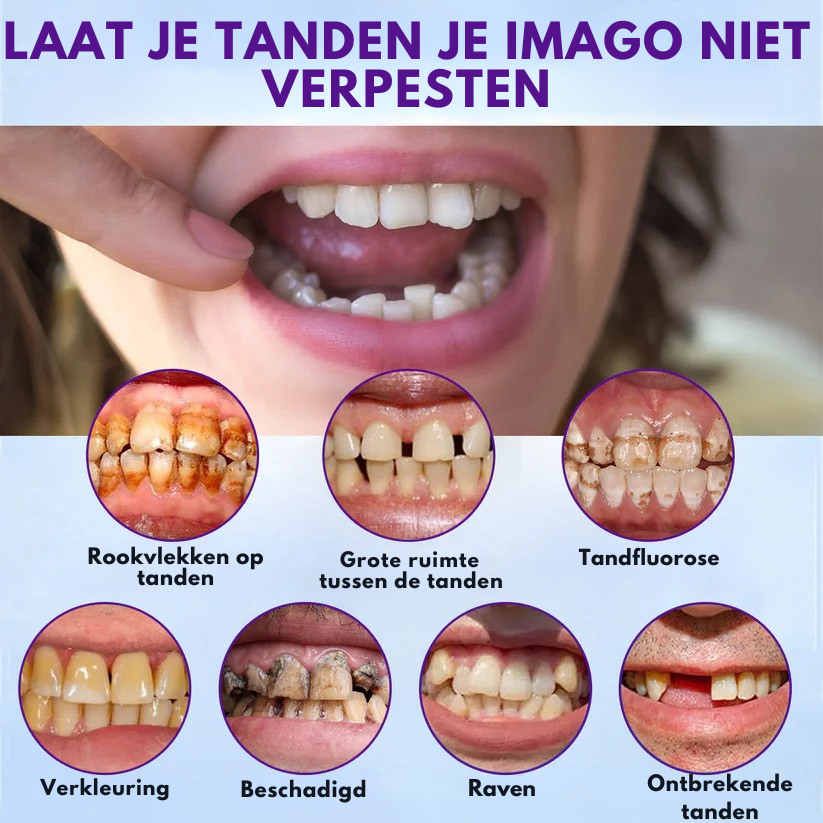 Vordela® Set van siliconen kunstgebitten nu 50% korting