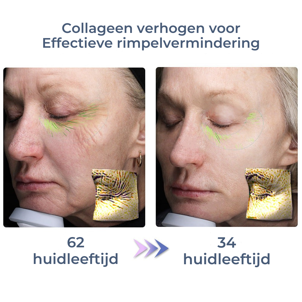 Vordela¨ geavanceerde-collageen-complete-oogcreme