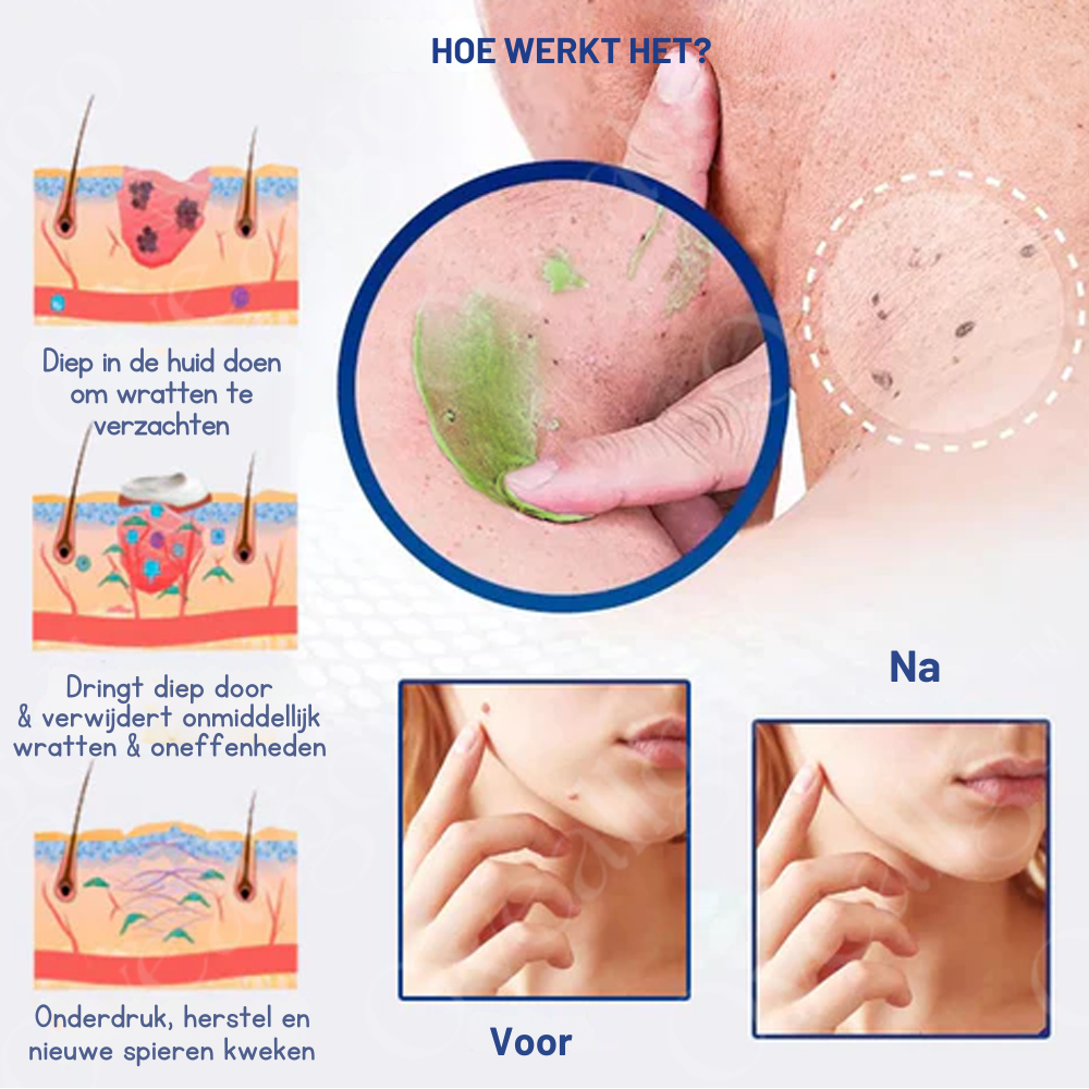 Vordela™ NatureErase Instant Mollen- en Vlekcrème