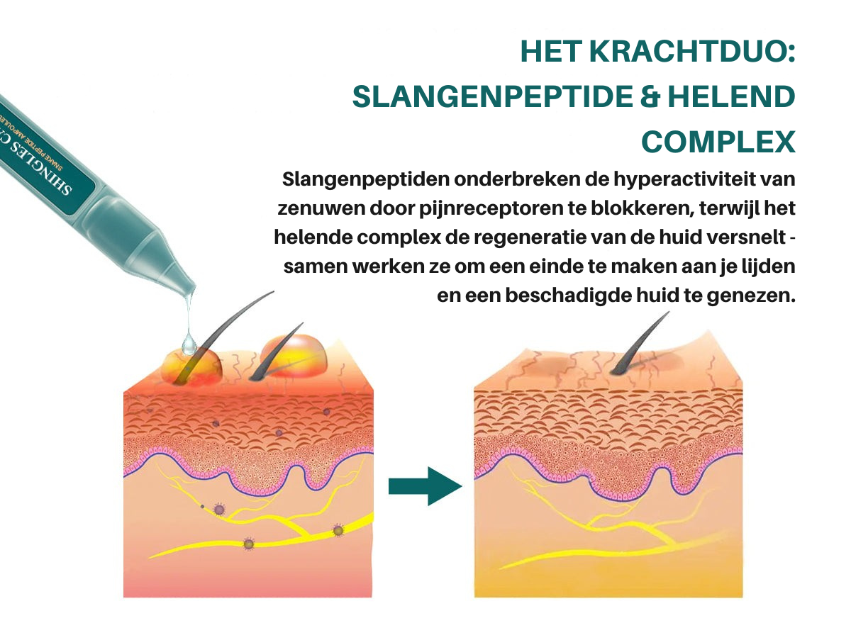Vordela® Shingles Kalm Slangenpeptide Ampullen