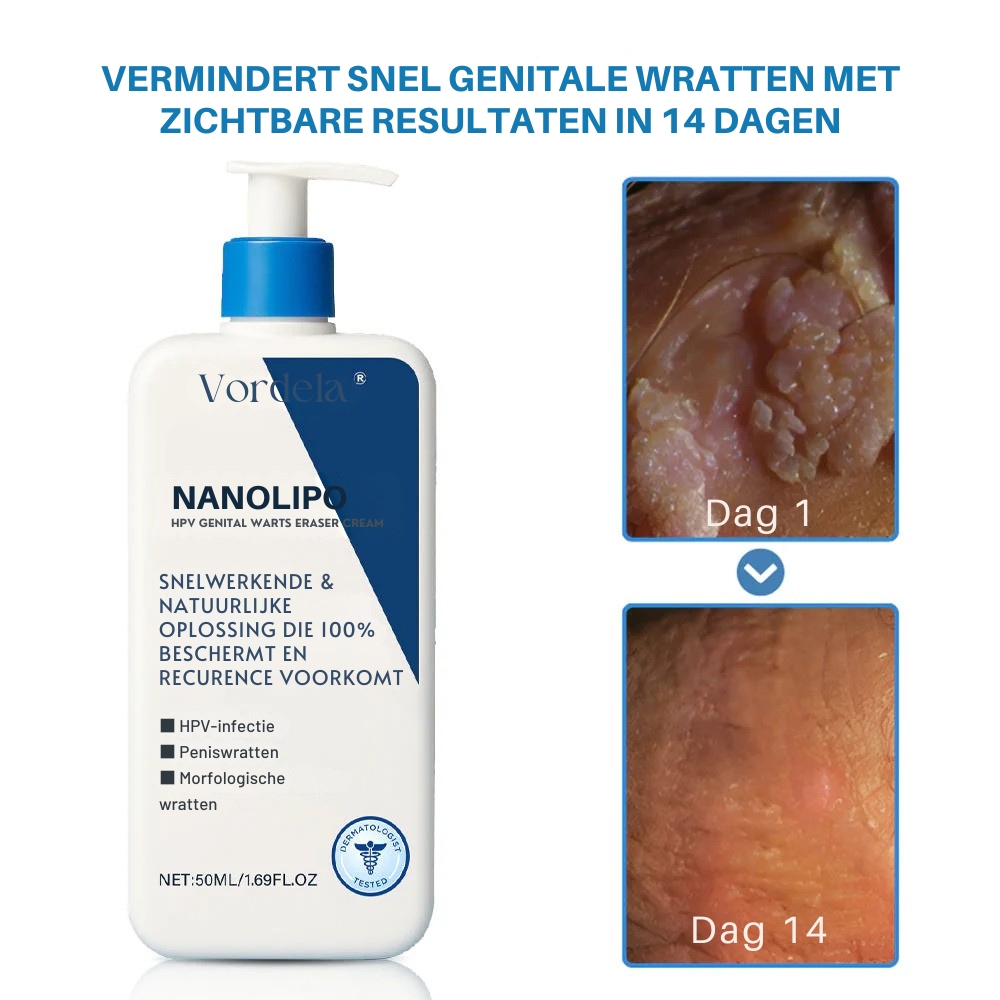 Vordela® NanoLipo HPV Genitale Wratten Waser Crème