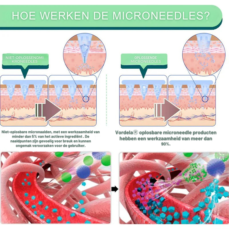 𝑂𝑓𝑓𝑖𝑐𝑖𝑎𝑙 𝑆𝑡𝑜𝑟𝑒 | Vordela® Nano-Microneedle Wellness Patch | Remt trek + Duurzame afgifte | In Nederland gemaakt