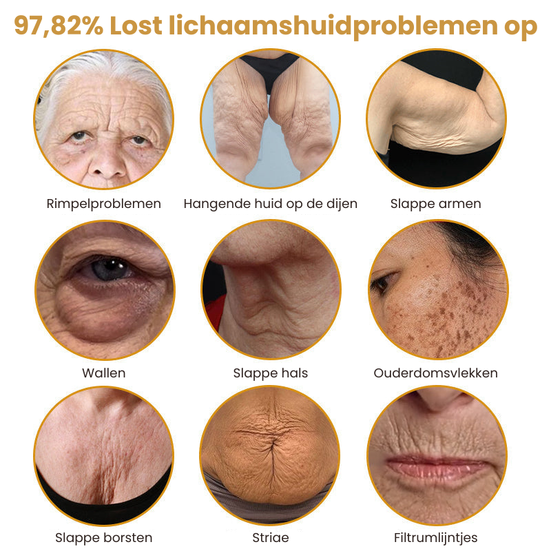 Vordela™ | Botox Rimpelverstevigende Crème