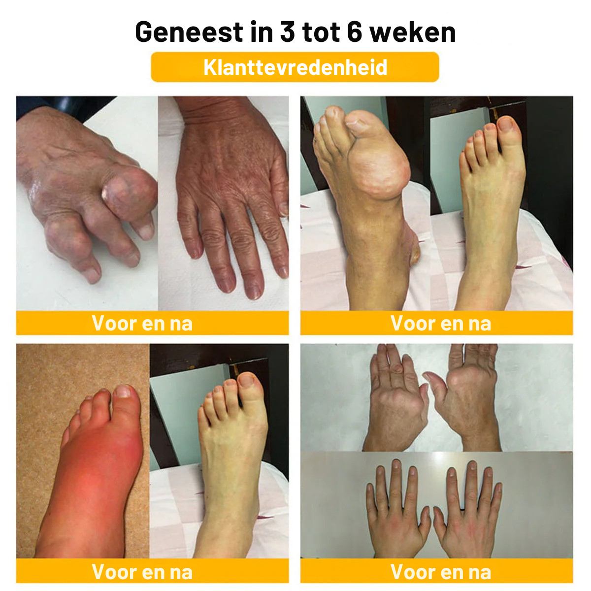 Gemaakt✨ en verzonden vanuit Nederland | ✅ Officiële winkel Vordela® Bijengif Pijnverlichtende Crème 🐝 🔥 Speciaal voor ouderen & aanbevolen door orthopeden