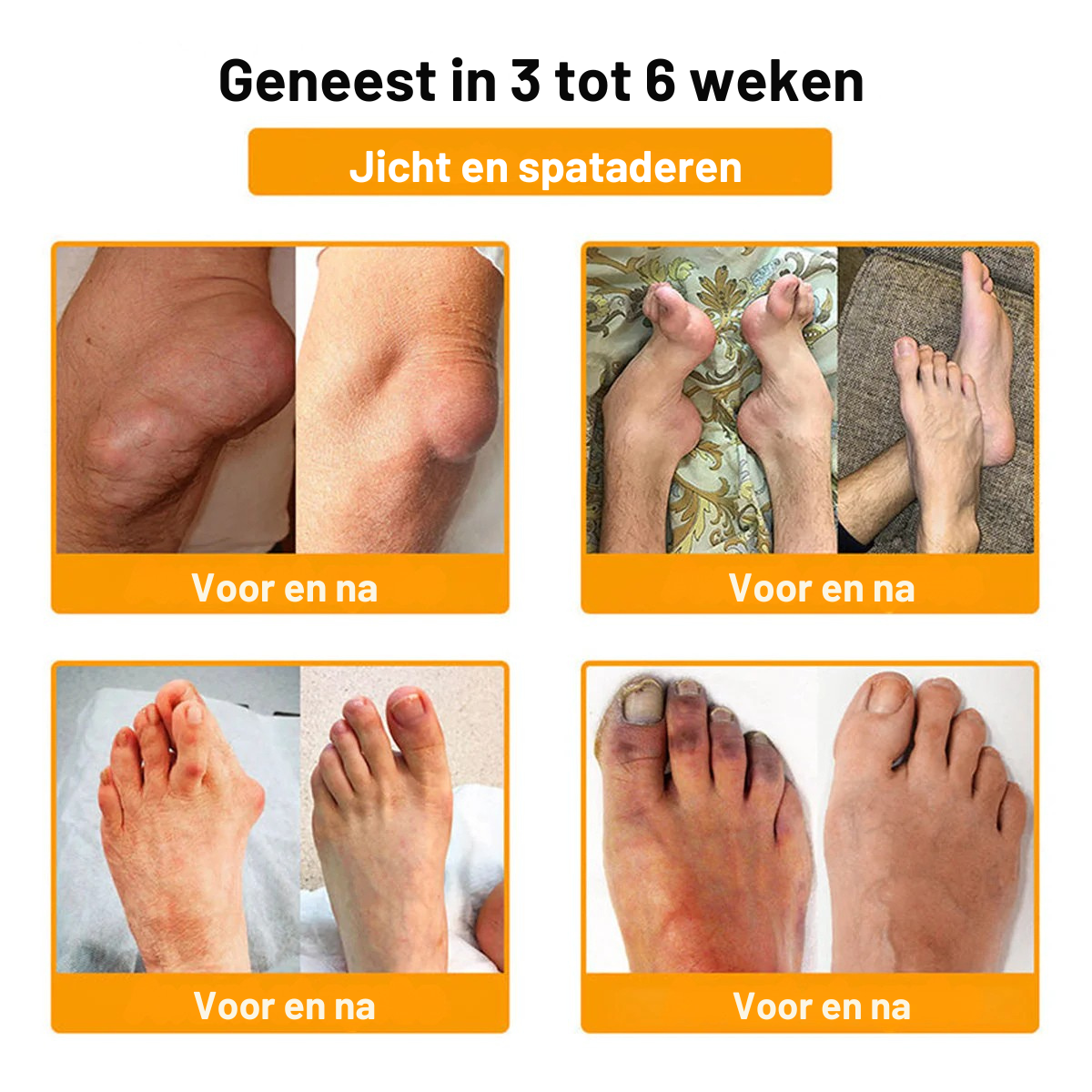 Gemaakt✨ en verzonden vanuit Nederland | ✅ Officiële winkel Vordela® Bijengif Pijnverlichtende Crème 🐝 🔥 Speciaal voor ouderen & aanbevolen door orthopeden