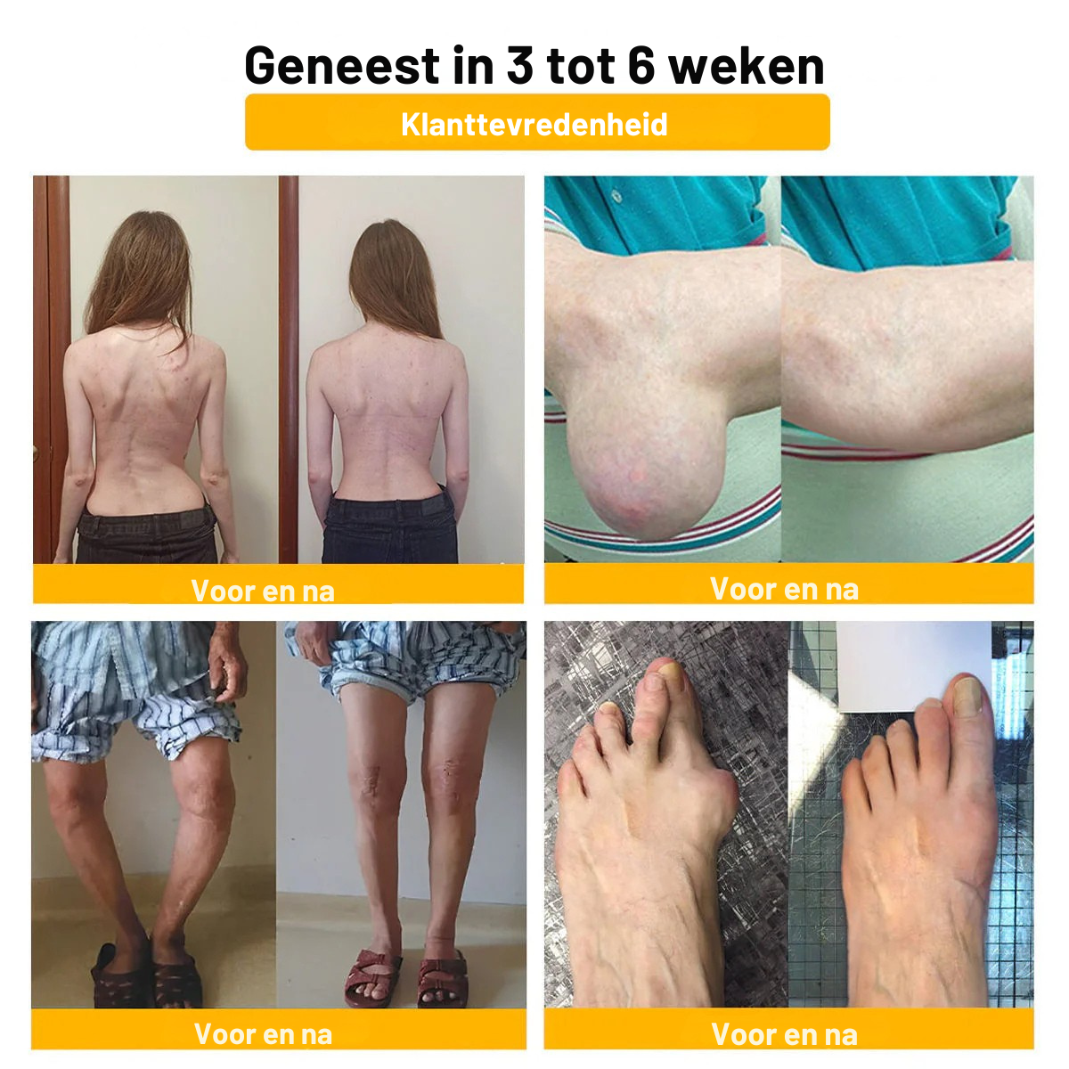 Gemaakt✨ en verzonden vanuit Nederland | ✅ Officiële winkel Vordela® Bijengif Pijnverlichtende Crème 🐝 🔥 Speciaal voor ouderen & aanbevolen door orthopeden