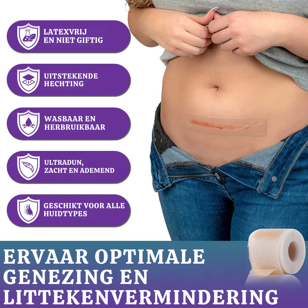 Vordela® 🏷️ ReGen Micronaald Tape met Nano-Hyaluronzuur 💊 Voor behandeling van littekens, striae, keloïden, acne, brandwonden en huidoneffenheden