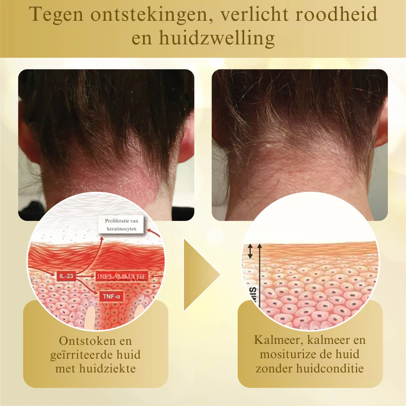 Vordela® Gecondenseerd Mellifera-gif Huidherstellende Crème
