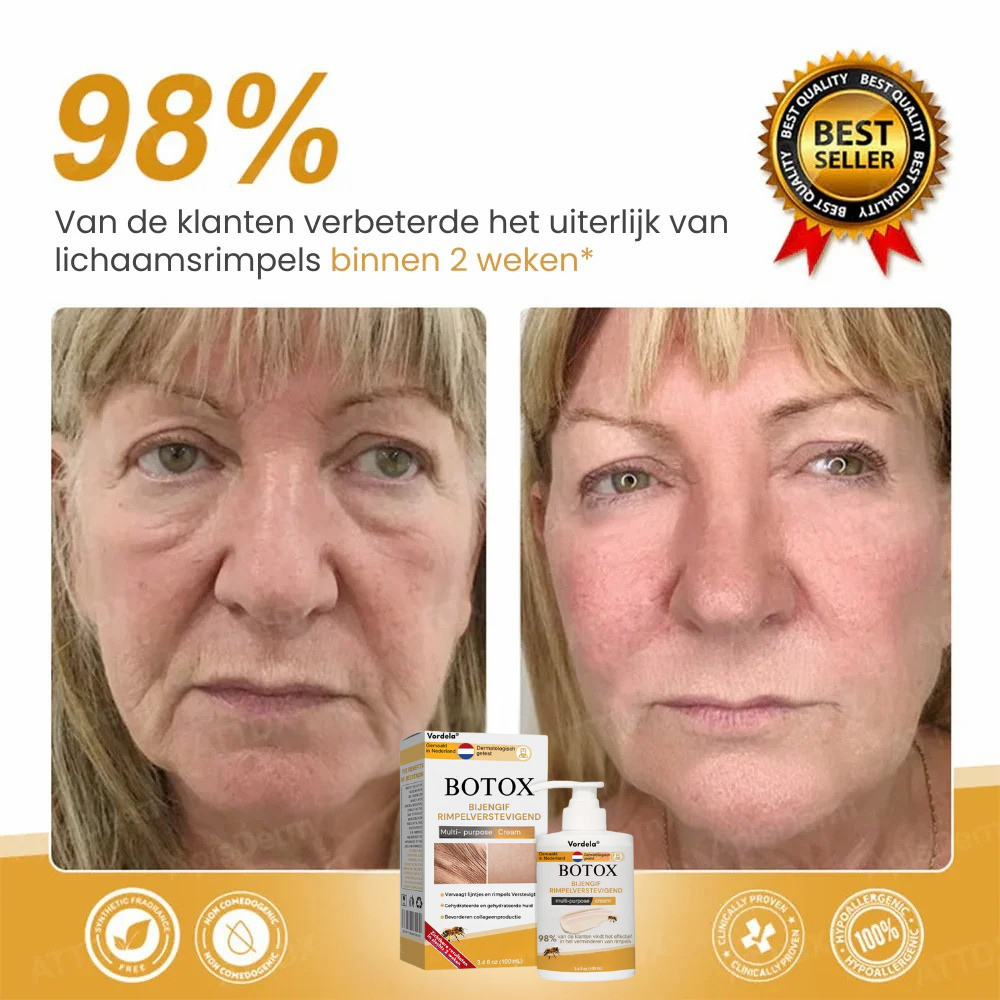 Vordela™ | Botox Rimpelverstevigende Crème