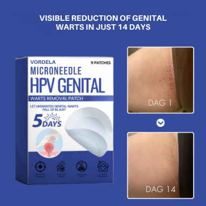 Vordela® Microneedle HPV Genitale Wratten Verwijderingspleister