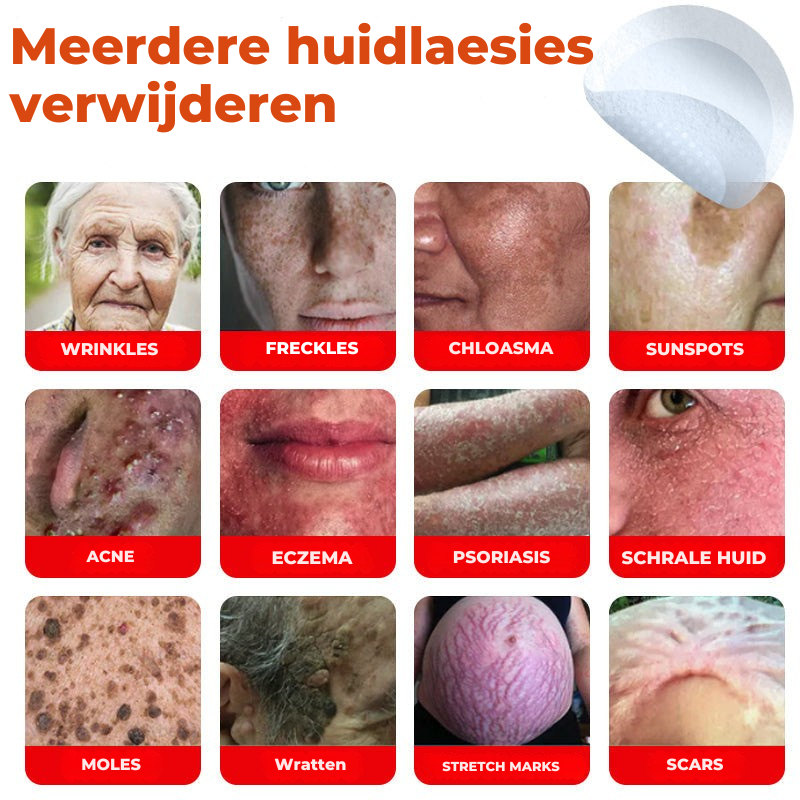 Vordela® MicroNeedle Botanic Skin Tag Removal Patch