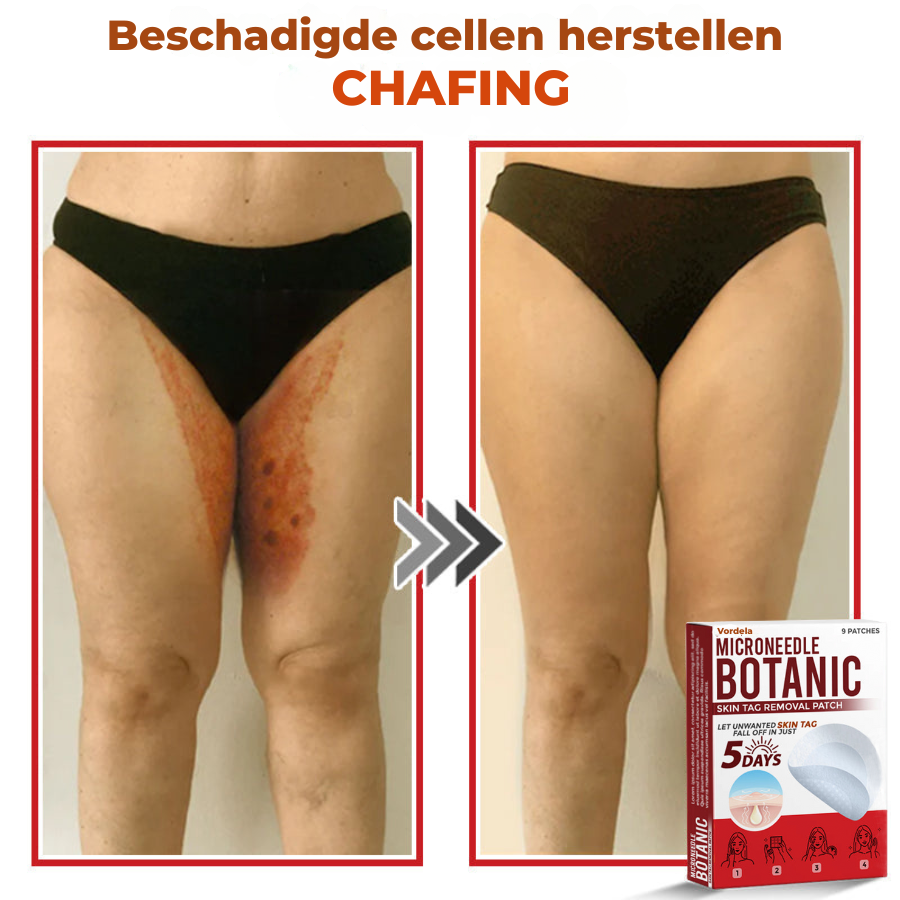 Vordela® MicroNeedle Botanic Skin Tag Removal Patch
