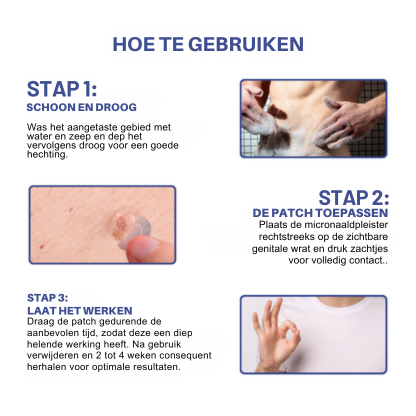Vordela® Microneedle HPV Genitale Wratten Verwijderingspleister