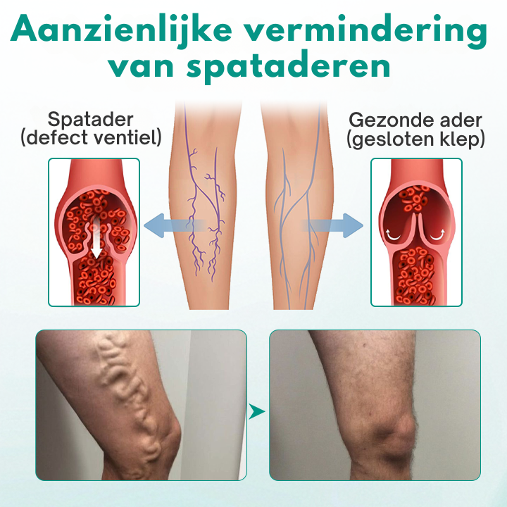 Vordela® BeenRevive Spataderen Patch