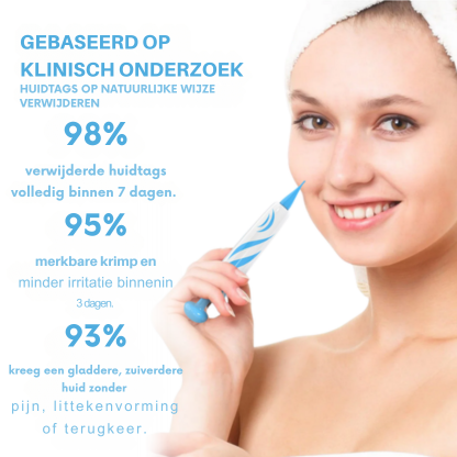 Vordela® pijnloze huidtagverwijderingspen voor thuisgebruik