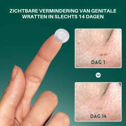 Vordela® Magnesium MicroPin HPV Genitale Wrat Verwijdering Patch