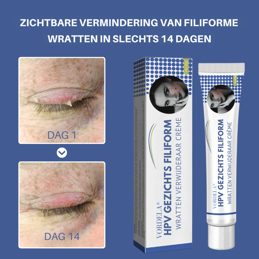 Vordela® HPV-filmvormige wratten verwijderingscrème