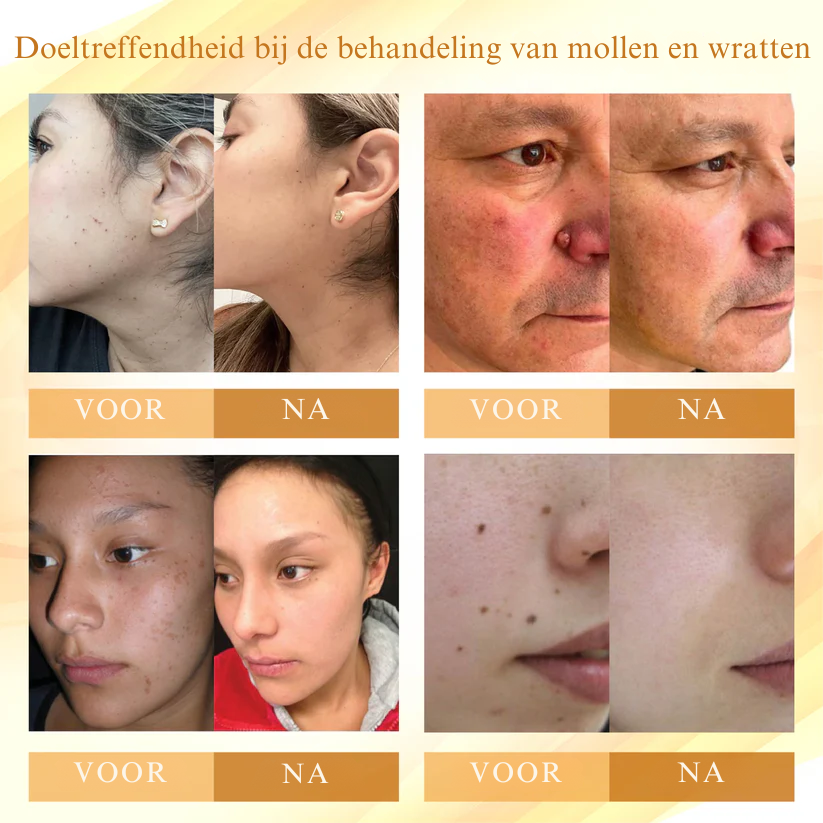 Vordela® Gecondenseerd Mellifera-gif Huidherstellende Crème