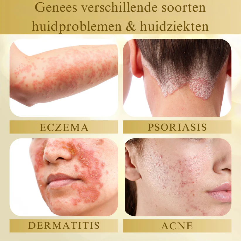 Vordela® Gecondenseerd Mellifera-gif Huidherstellende Crème
