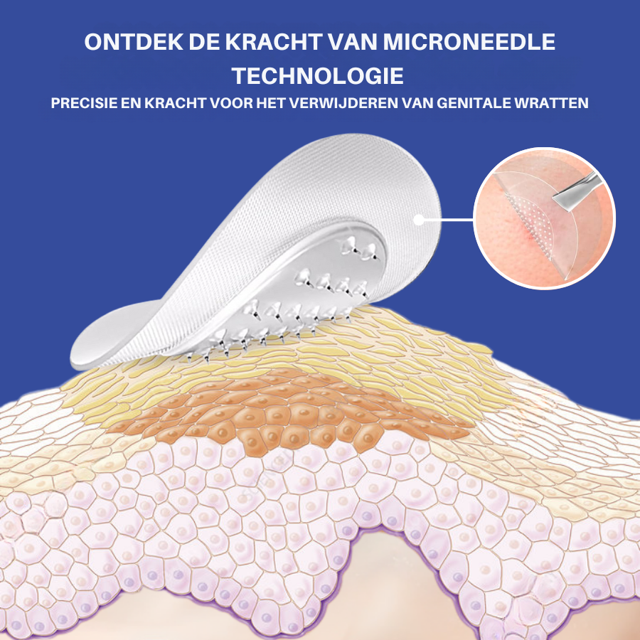 Vordela® Microneedle HPV Genitale Wratten Verwijderingspleister